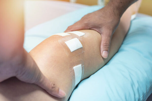 Post-Operative Rehabilitation